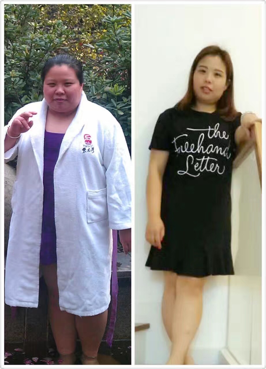 难怪你这么胖,经络都堵了