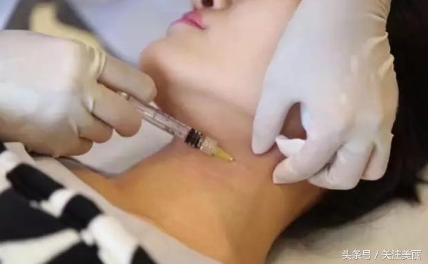 玻尿酸填充真的会好看吗,玻尿酸填充是不是越来越丑