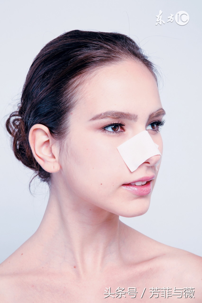 黑头到底怎么去啊,哪种黑头是去不掉的