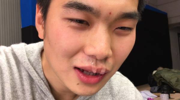 杭州一父母给孩子口服泡腾片，没想到后果竟这么严重，半条命快没了