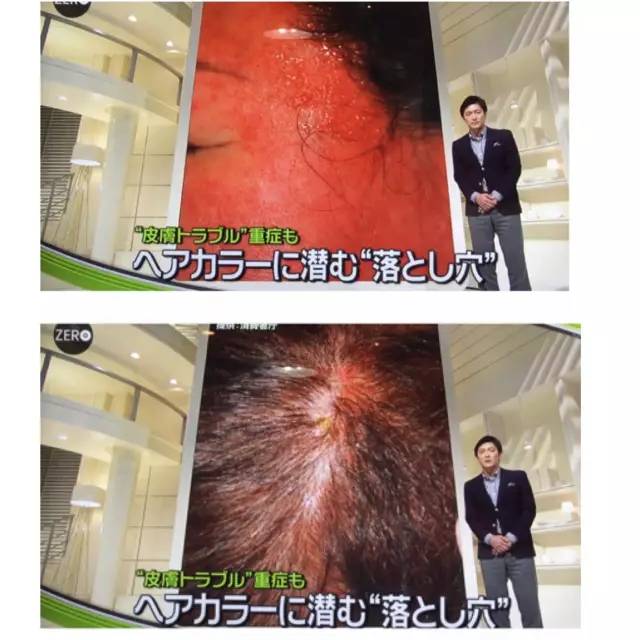 日本女性染发的危害,日系染发的危害