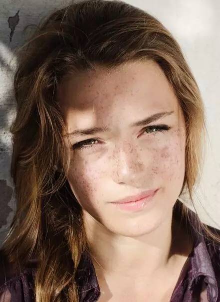 皮肤变黑恢复要多久,皮肤修复反黑要多久正常