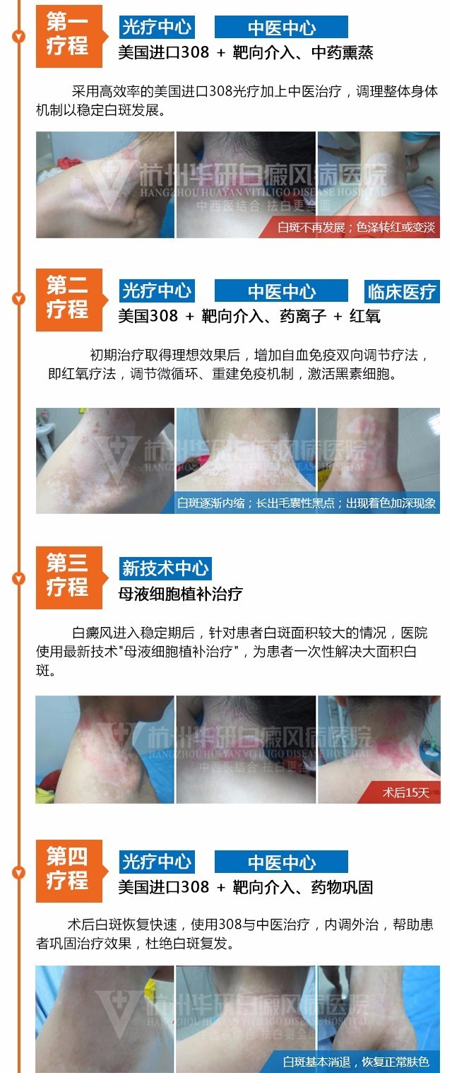 「无限白斑泪谁言患者心」白癜风能治好吗？他说能！