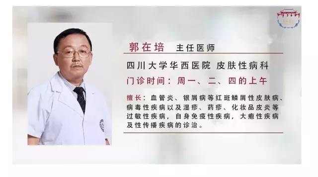 牛皮癣好了告别银屑病,华西看银屑病厉害的医生