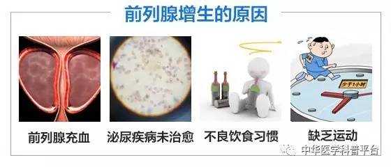 前列腺增生的健康科普,科普1分钟自查前列腺增生