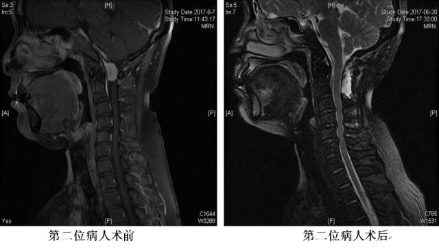 青大附院下雨时间表,青大附院下雨时间