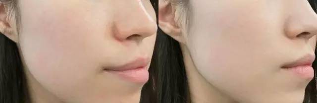 夏季定妆持久不脱妆粉饼,夏季脱妆怎么办用什么粉饼好