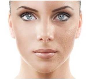 胎盘霜国货经典,胎盘保湿霜