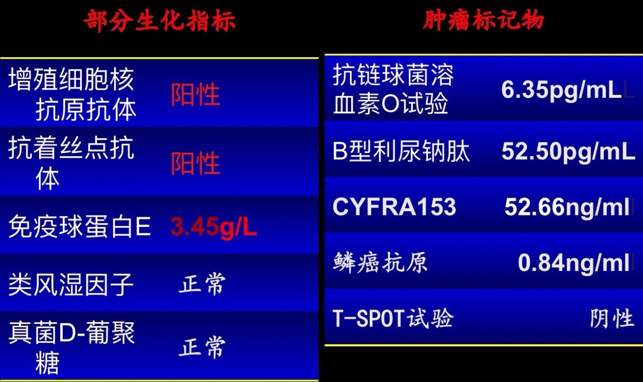 喘息、呼衰1年,问病史才发现是这个病!