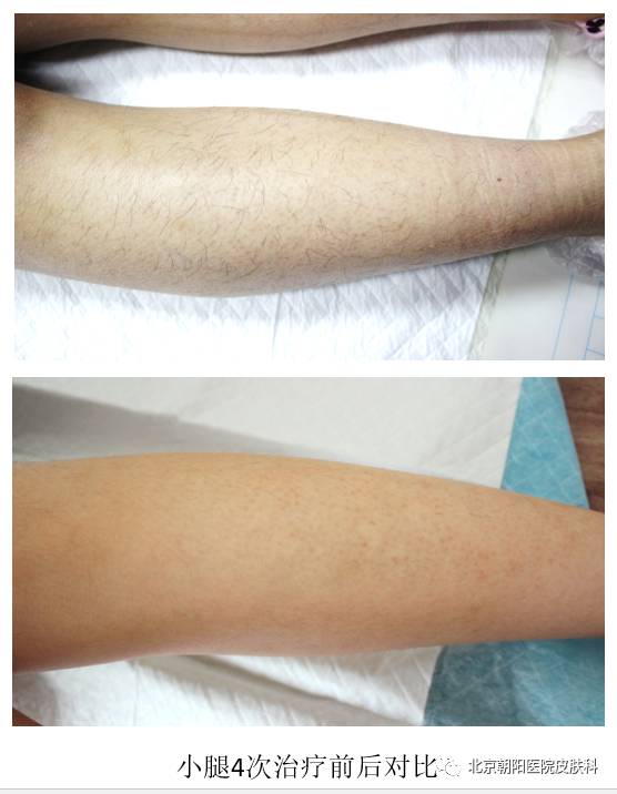 聊一聊护肤的那些事儿,聊一聊减重那些事儿