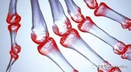 鍚箍鎾殑鍗卞,鍚箍鎾埄涓庡紛