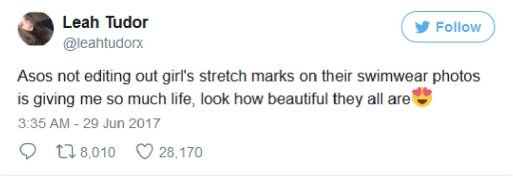 ASOS做了个振奋人心的决定启用有妊娠纹的模特