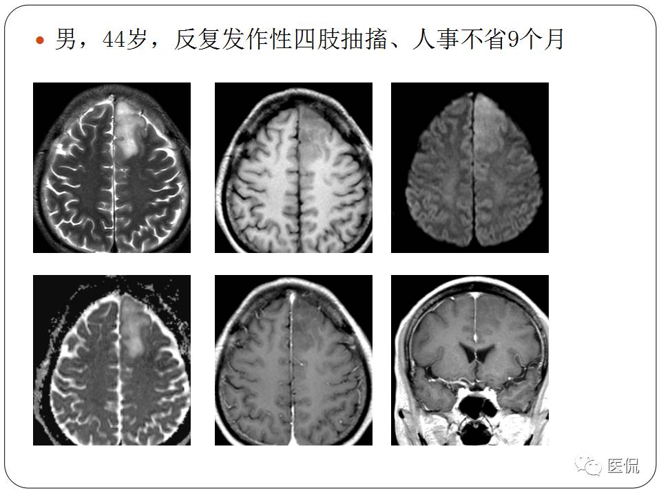 神经系统解剖ppt课件,神经内科课件ppt