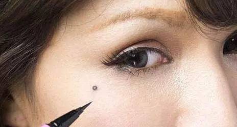 身上长痣小心癌变,身上的痣会癌变吗