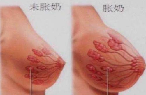 母乳堵奶最好的解决方法,堵奶自救母乳妈妈该怎么做