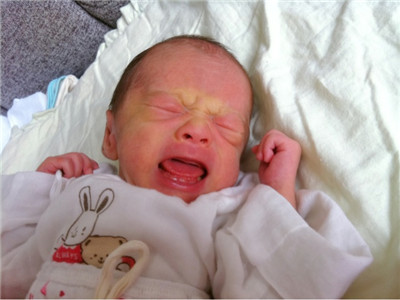 刚出生的宝宝长什么样？这里五大现象，看得心发慌