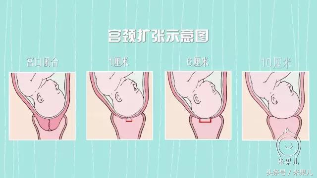 米果儿：直击分娩全过程！了解得多，担心自然就少了