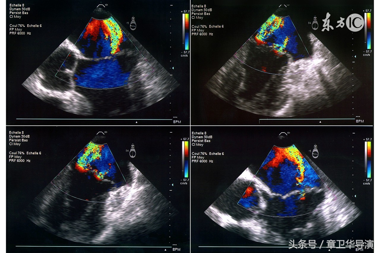 孕妈必知的胎教常识,超声检查孕妈妈一定要了解