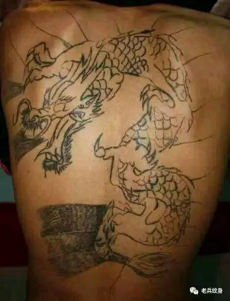 洗纹身哪种情况会留疤,洗纹身用什么药修复不留疤