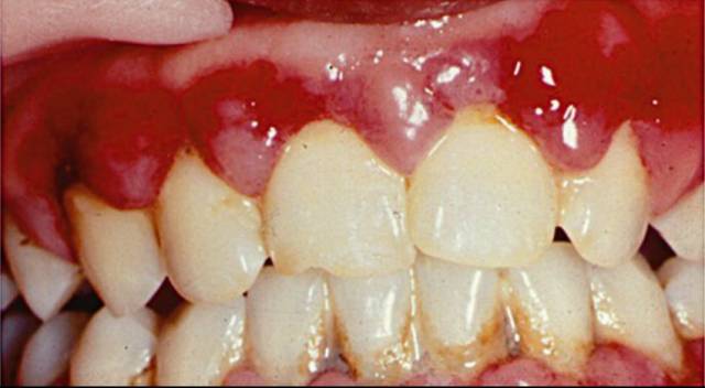 从来都没洗过牙的视频,有多少人从来没有洗过牙