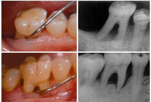从来都没洗过牙的视频,有多少人从来没有洗过牙