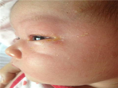 刚出生的宝宝长什么样？这里五大现象，看得心发慌