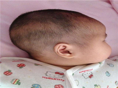刚出生的宝宝长什么样？这里五大现象，看得心发慌