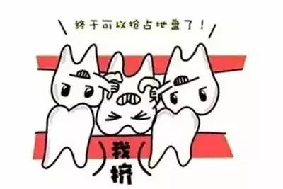 替牙期牙齿需要矫正吗,替牙期牙齿