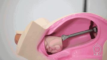 米果儿：直击分娩全过程！了解得多，担心自然就少了