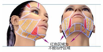 超声刀美容真有效果吗,超声刀美容导致的皮肤危害有哪些