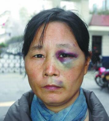 小女孩把别人的眼睛踢肿了,她奶奶说,踢死你也够不着判刑!