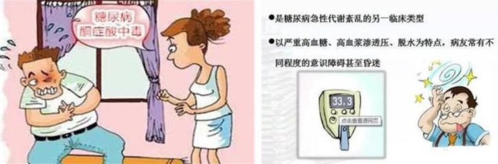 既得了脑梗又得了心梗,老想大便是脑梗心梗征兆吗