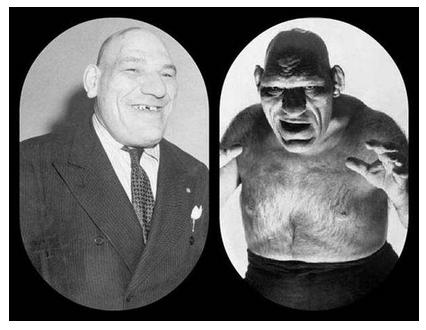 脑垂体瘤变丑,垂体瘤引起肢体肥大症能恢复吗