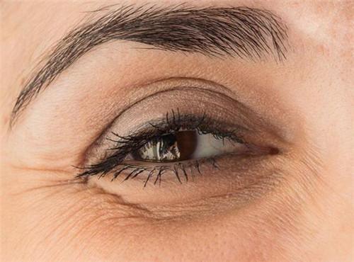 脸上的皱纹怎么去掉最好方法,脸上的皱纹怎么去除最简单的方法