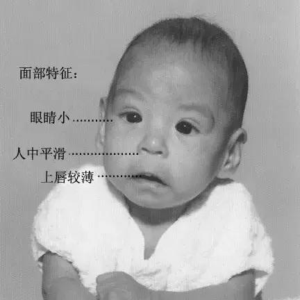 孕早期喝葡萄酒有什么影响,孕妈喝葡萄酒