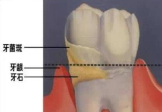 从来都没洗过牙的视频,有多少人从来没有洗过牙
