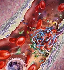 既得了脑梗又得了心梗,老想大便是脑梗心梗征兆吗