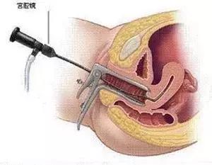 陪闺蜜看妇科,顺道“长”了知识!