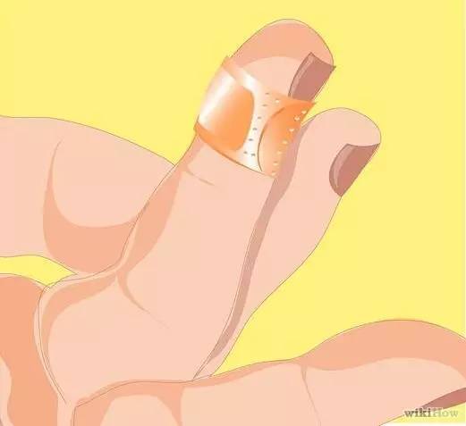 鱼钩钩到手指怎么办,鱼钩钩住手会得破伤风吗