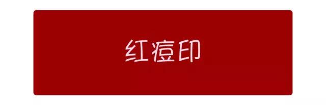 娣″寲鐥樺嵃鐥樺潙姣涘瓟绮楀ぇ鐢风敓,骞垮窞娣″寲鐥樺嵃鐥樺潙姣涘瓟绮楀ぇ