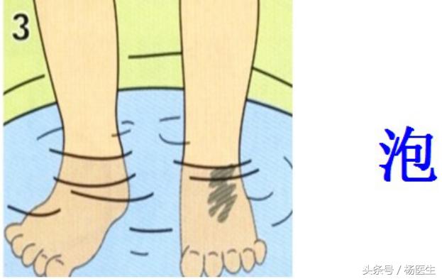 烫伤家庭急救五字诀,烧烫伤急救五部曲图片