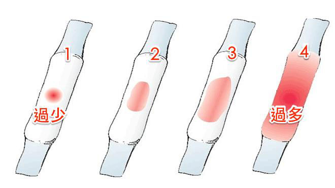 经期十大毛病,月经迟迟不来会是肿瘤吗