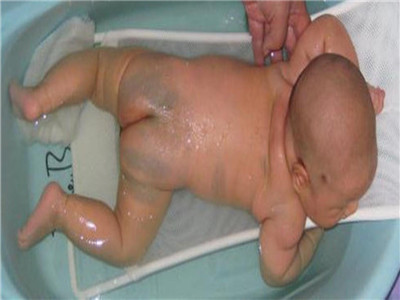 刚出生的宝宝长什么样？这里五大现象，看得心发慌