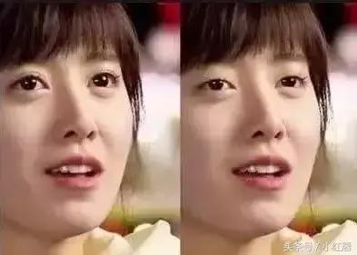 闺蜜割了双眼皮,割了双眼皮后悔了一个月