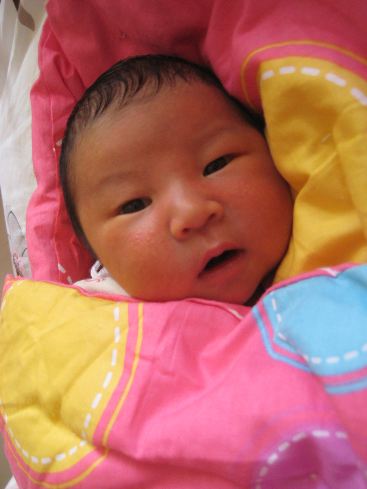 产前备用：快速识别新生儿黄疸症状及解决办法