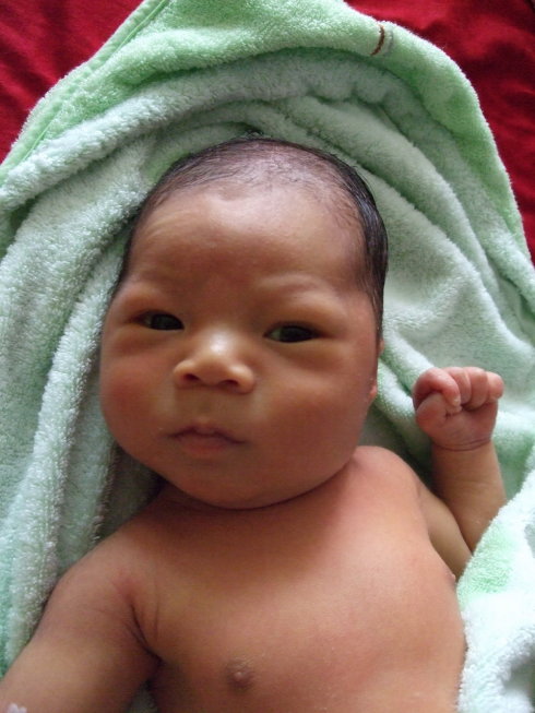 产前备用：快速识别新生儿黄疸症状及解决办法