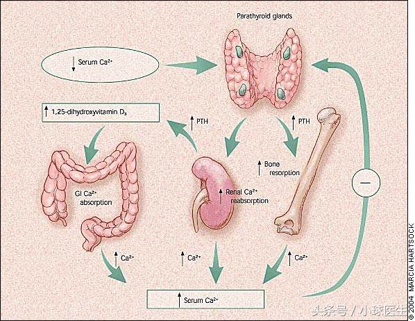 肾友有奖问答,肾衰怎么导致甲旁亢