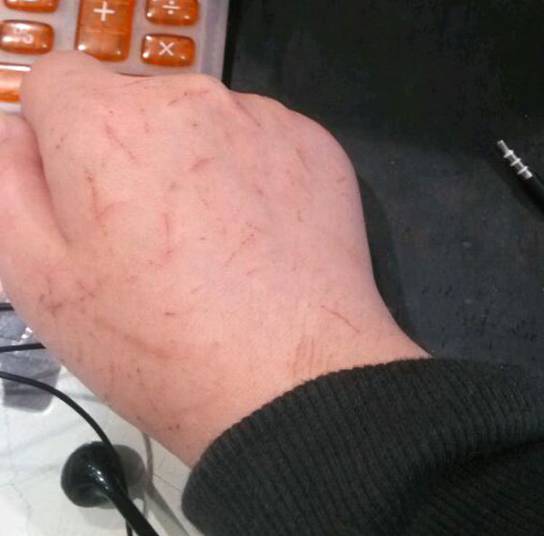 猫咪牙齿被划伤,猫咪牙齿被磕碎了