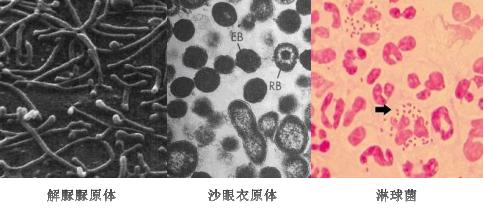 你不知道的几种有害病菌，每天生存在这里，可能导致不孕！