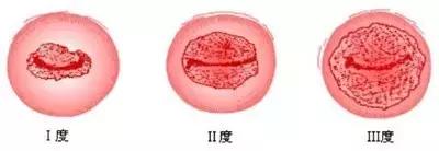 陪闺蜜看妇科,顺道“长”了知识!